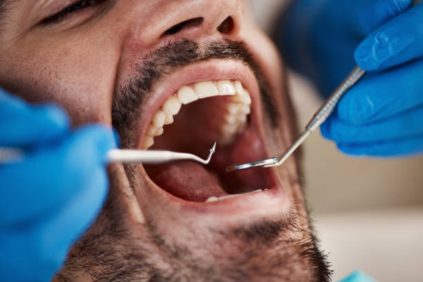 Best Walk-In Dentist Near Me  in Tishomingo, OK