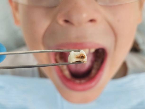 Best Urgent Dental Care  in Tishomingo, OK